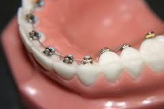 ortodontija